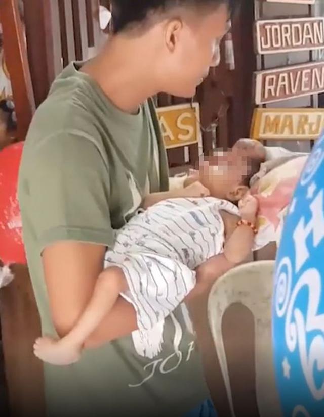 Mẹ bầu tự uống thuốc khi sốt và lười siêu âm, sốc nặng khi nhìn mặt con lúc chào đời - 2
