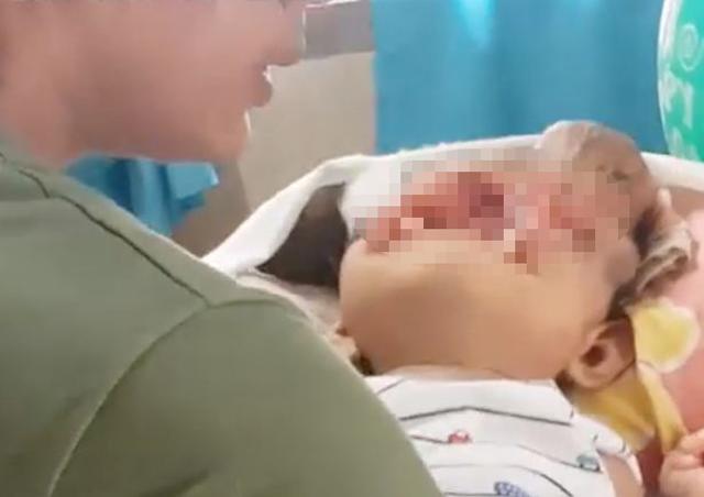 Mẹ bầu tự uống thuốc khi sốt và lười siêu âm, sốc nặng khi nhìn mặt con lúc chào đời - 1