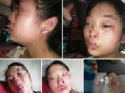 Tin tức - Sản phụ 16 tuổi cầu cứu vì chồng bạo hành: Người chồng lên tiếng phân trần