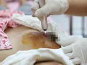 Bà bầu - Mẹ Tuyên Quang chịu đau đớn, bầu ngực chảy mủ vì tự ý đắp lá trị tắc tuyến sữa