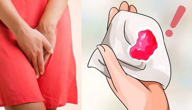 Kinh nguyệt là gì và những điều không phải chị em nào cũng biết - 5