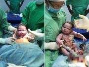 Bà bầu - Em bé "gây bão" vì chào đời không thèm khóc, chưng ngay vẻ mặt: "Sao lại lôi cháu ra đây!"