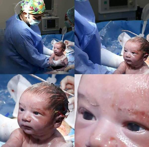 Not only make face amp;#34;old-imp;#34;, just born babies have amp;#34;t-hund-typeamp;#34; expressivity - 2