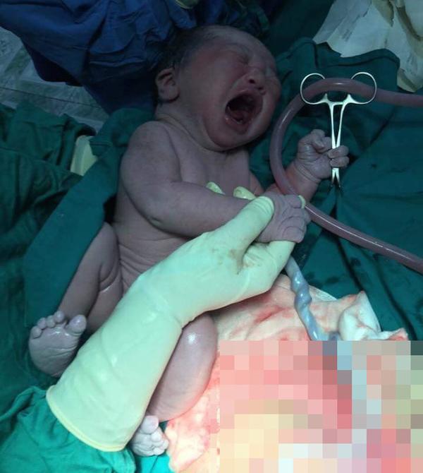 It’s not just amp;#34;old-impamp;#34;, just born, babies have amp;#34;t-hund-typesamp;#34; expressivity – 4