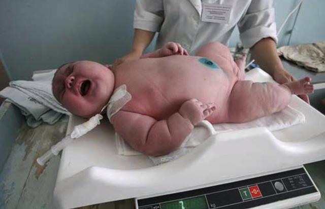 me chi an mi va khoai, be trai sinh ra nang 7,7 kg khien bac si soc nang - 1