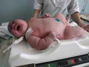 Tin tức - Mẹ chỉ ăn mì và khoai, bé gái sinh ra nặng 7,7 kg khiến bác sĩ sốc nặng