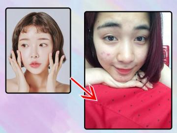 Những sai lầm ngày nào cũng mắc khiến mặt bạn ngày càng nhiều mụn hơn