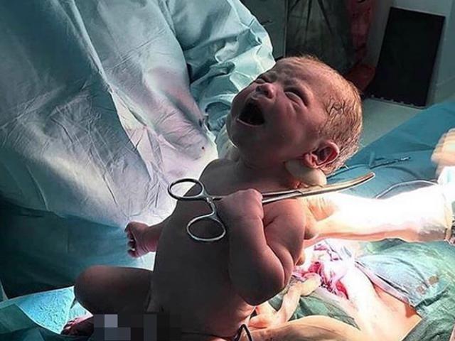 Thêm một em bé vừa lọt lòng đã cướp kéo của bác sĩ: Hãy để cháu tự cắt dây rốn!