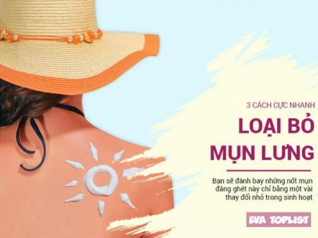 Mách bạn 3 cách loại bỏ mụn lưng cực nhanh lại siêu lành tính