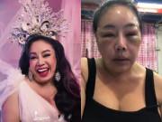 Tin tức - Nữ đại gia tuyển chồng "yêu" 28 lần/ngày xuất hiện với gương mặt sưng phù vì bị chồng đánh đập?