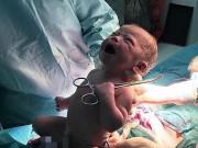 Bà bầu - Thêm một em bé vừa lọt lòng đã cướp kéo của bác sĩ: “Hãy để cháu tự cắt dây rốn!”