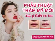 Làm đẹp - Những lưu ý trước và sau khi phẫu thuật thẩm mỹ môi
