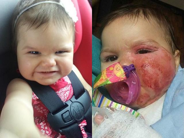 Để con trong xe tập đi rồi lơ là, người mẹ khiến con 1 tuổi gặp tai nạn kinh hoàng