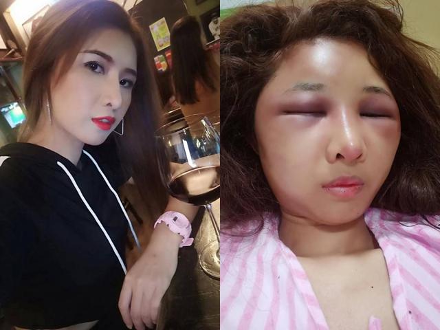 Để người yêu cũ đưa về nhà, vợ xinh đẹp bị chồng đánh đập đến nỗi không nhận ra