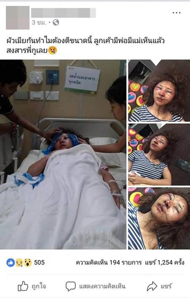 Để người yêu cũ đưa về nhà, vợ xinh đẹp bị chồng đánh đập đến nỗi không nhận ra - 1