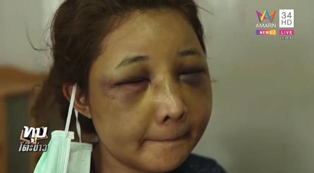 Để người yêu cũ đưa về nhà, vợ xinh đẹp bị chồng đánh đập đến nỗi không nhận ra - 4