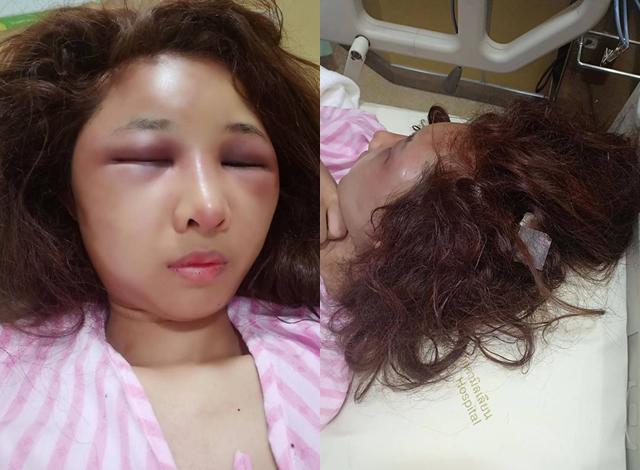 Để người yêu cũ đưa về nhà, vợ xinh đẹp bị chồng đánh đập đến nỗi không nhận ra - 3