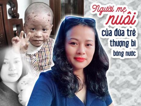 Mẹ đơn thân bán 2 căn nhà cưu mang bé bị bệnh nặng, mỗi tháng tiêu tốn 100 triệu đồng