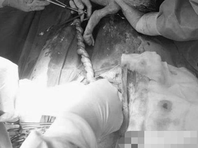 Đang mang bầu 38 tuần, mẹ U40 “chết đứng” sau khi đến bệnh viện khám thai - 2