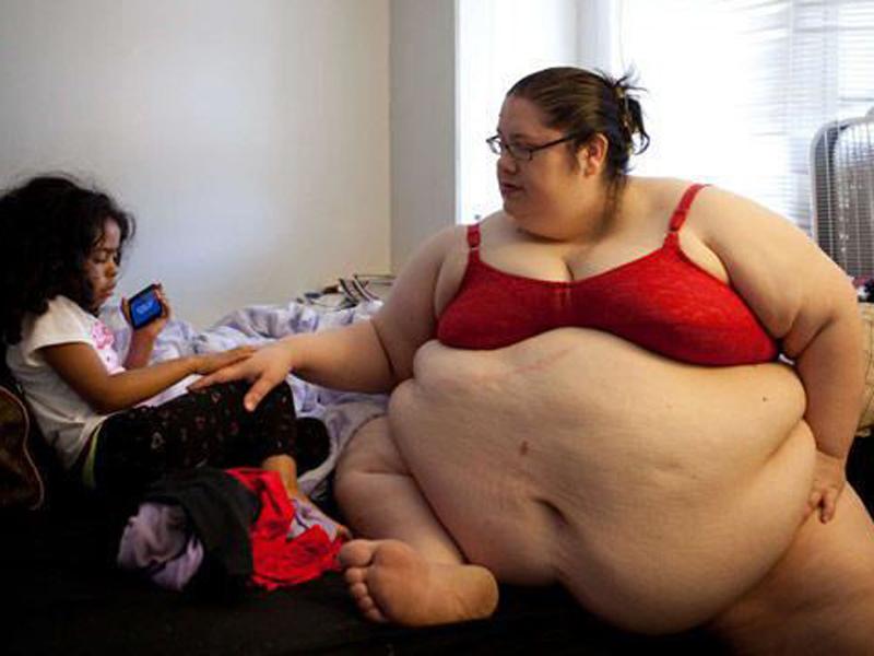 Năm 2007, Donna Simpson (sống tại Ohio, Mỹ), nặng 241kg, đã trở thành người phụ nữ nặng cân nhất thế giới mang thai và sinh con bất chấp những bất lợi về sức khỏe của mình.
