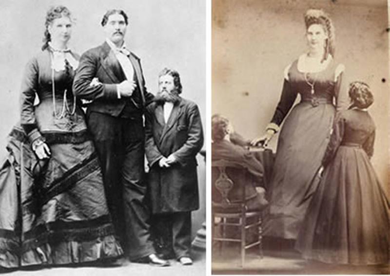Người sở hữu cơ quan sinh dục nữ 'khủng' nhất nhiều khả năng thuộc về cô nàng người Scotland Anna Swan (1846 - 1888), năm 19 tuổi, Swan được cho là sở hữu âm đạo 'khủng' nhất thế giới với kích thước 48 cm.
