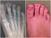 Sức khỏe - Những sự thật bất ngờ bạn chỉ thấy được qua phim chụp X-quang, điều cuối cùng gây sửng sốt