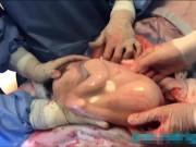 Tin tức - 5 ca sinh con lạ lùng nhất thế giới: Anh em sinh đôi nhưng khác cả bố lẫn mẹ