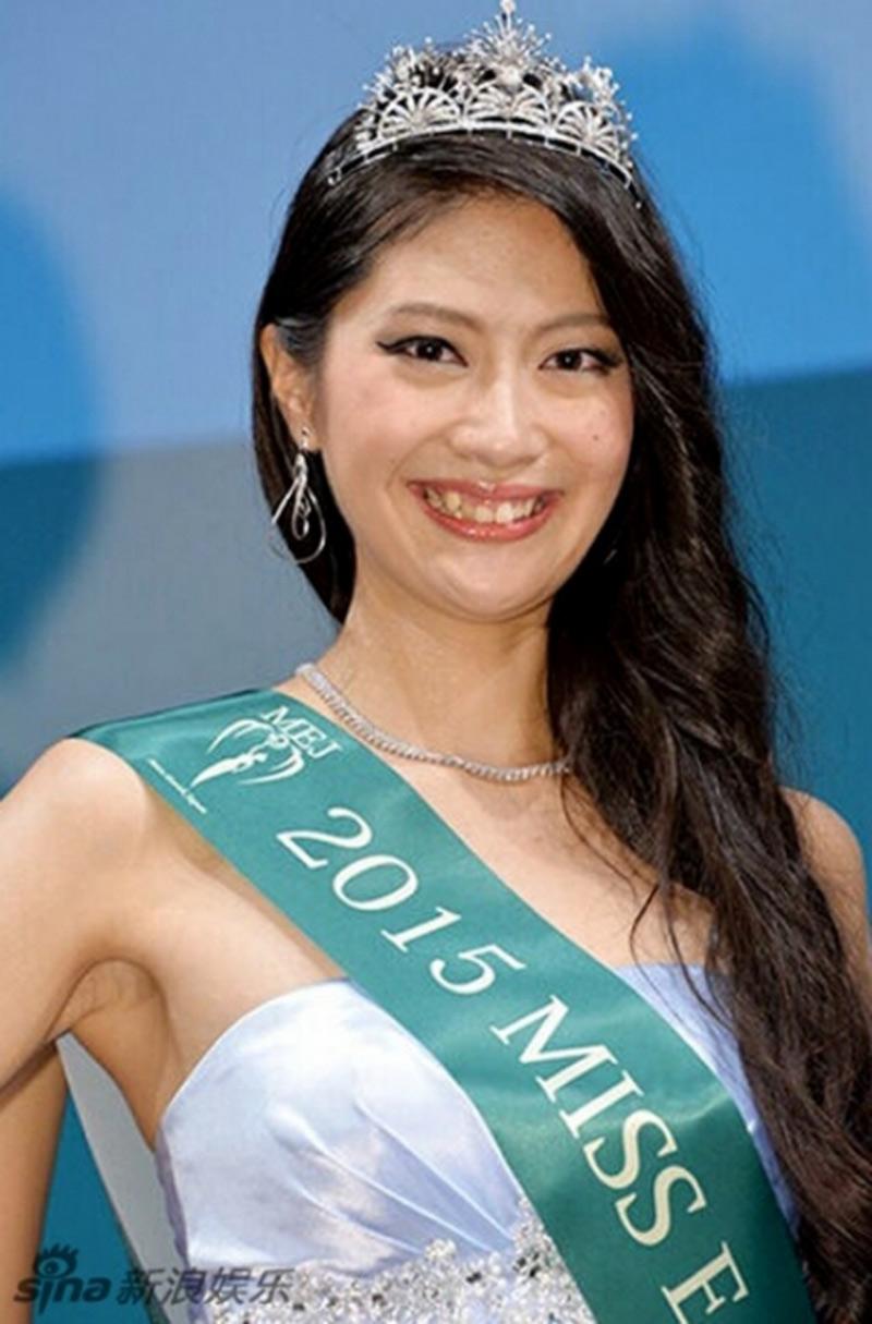 Ayano Yamada cũng đăng quang Hoa hậu Trái đất Nhật Bản 2015 với hàm răng khấp khểnh ố vàng, nhan sắc kém xinh.
