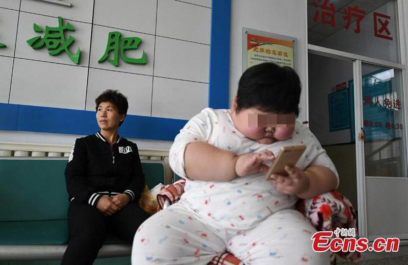 Trường hợp cậu bé mới 7 tuổi ở Trung Quốc đã nặng tới 40kg, thân hình núng nính thịt gây xôn xao mạng xã hội những ngày qua. Đặc biệt, khi được thăm khám, bác sĩ nhận định cậu bé bị suy dinh dưỡng. (Ảnh minh họa)
