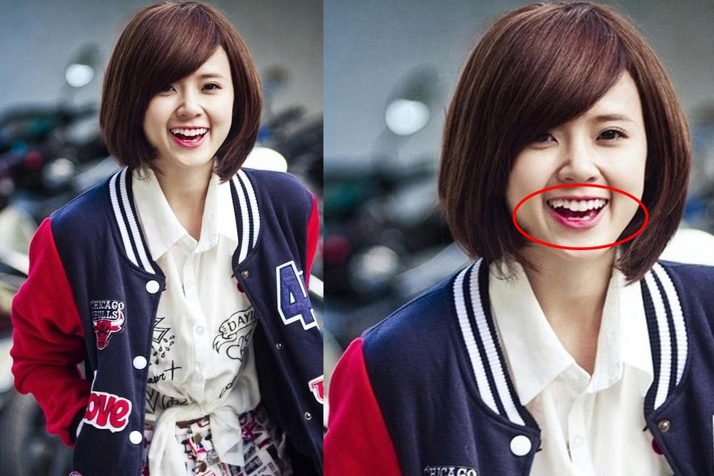 Đẹp như sao Việt cũng có lúc lộ cả dàn khuyết điểm như thế này - 5