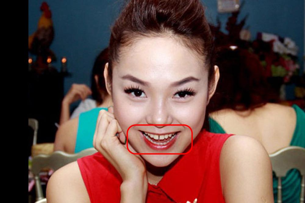 Đẹp như sao Việt cũng có lúc lộ cả dàn khuyết điểm như thế này - 6