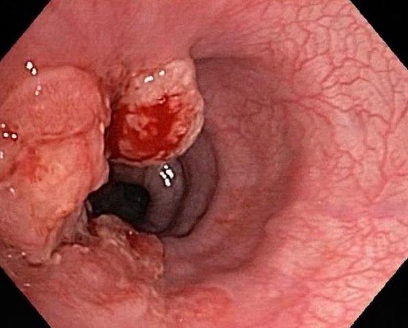 chang trai 30 tuoi duoc chan doan chi song noi 3 thang vi can benh co the di truyen - 3