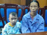 Tin tức - Bé trai 5 tuổi sống trong thân hình “người cóc” vì sai lầm của mẹ hiện giờ ra sao?