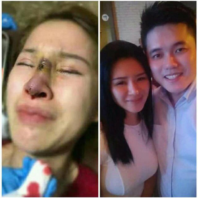 nghe tin con gai bi chong bao hanh, bo vo dich than vut con re toi boi ngay giua pho - 5