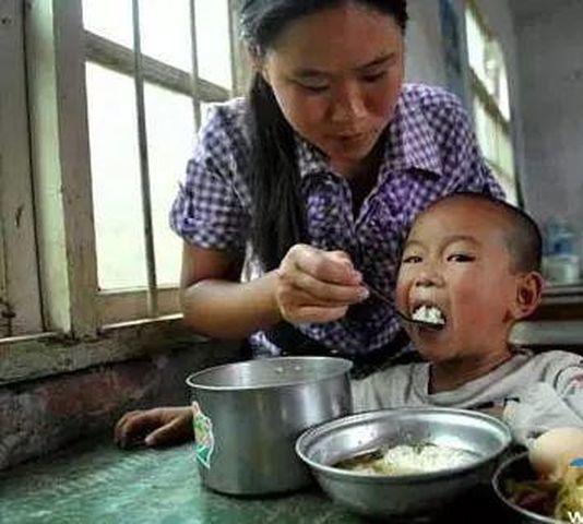 cau be 11 tuoi bi ung thu giai doan cuoi, cha me hay dung cho tre an do du thua - 2