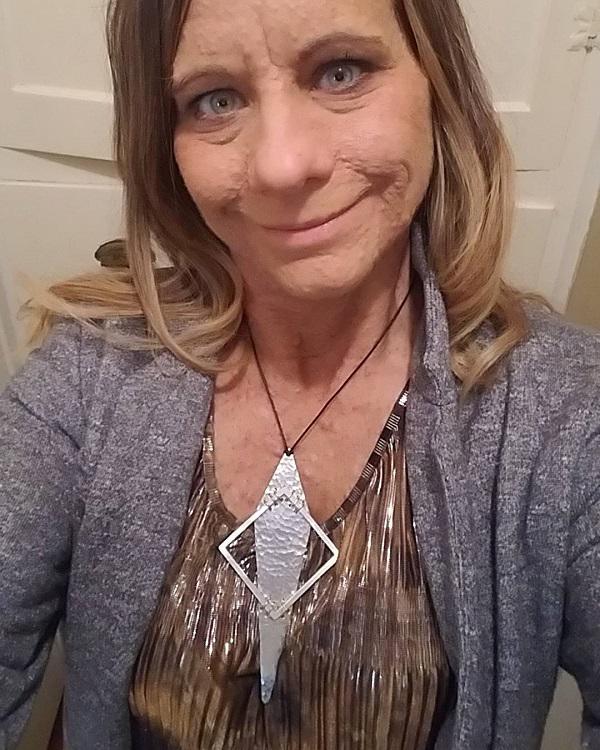 dung cam cat bo 6000 u thit, ca the gioi bat ngo ve nhan sac cua nguoi phu nu nay - 8