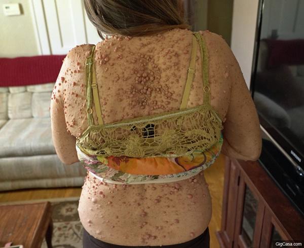 dung cam cat bo 6000 u thit, ca the gioi bat ngo ve nhan sac cua nguoi phu nu nay - 3