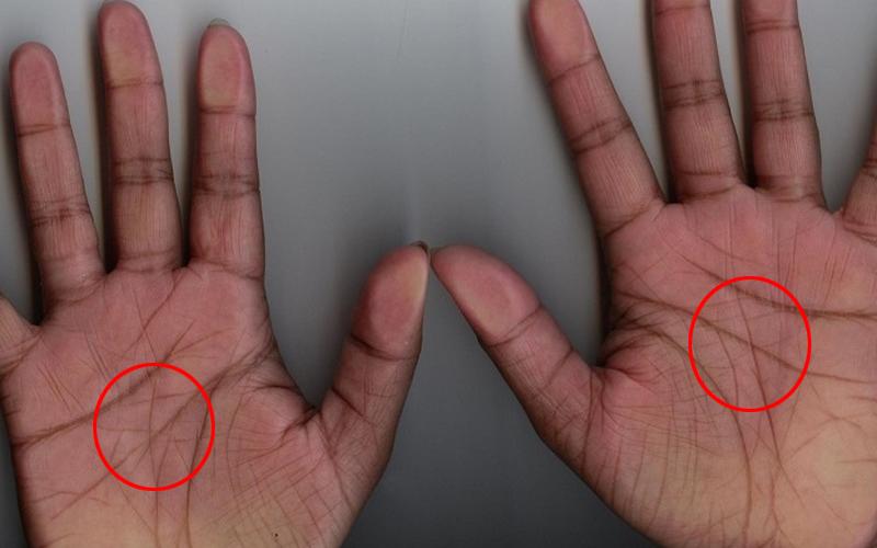 Những đường chỉ tay tạo thành hình chữ X và xuất hiện ở cả hai bàn tay được xem là một hiện tượng cực kỳ hiếm, chỉ có 3% dân số thế giới sở hữu đặc điểm này. 
