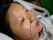 Bà bầu - Một tuần 4 lần lọc máu, mẹ bầu trẻ "sức cùng lực kiệt" vẫn xin được giữ lại con