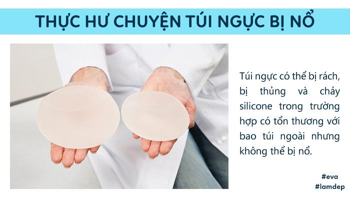 cau tra loi bat ngo tu chuyen gia: "tui nguc co the bi rach, thung,... chu khong the bi no!" - 4
