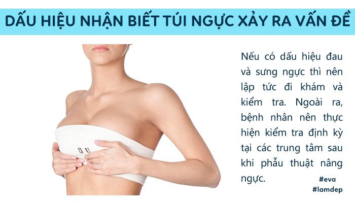 cau tra loi bat ngo tu chuyen gia: "tui nguc co the bi rach, thung,... chu khong the bi no!" - 6