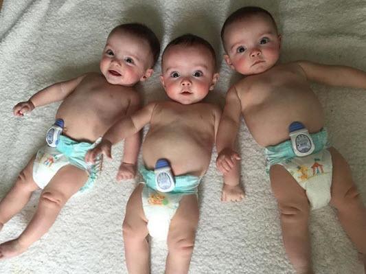 sinh 3 binh thuong, vai nam sau thay ky la, me mang adn xet nghiem thi chan dong the gioi - 5