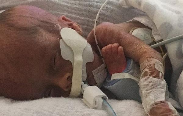 vao vien sinh doi, me tre dau don om 2 chiec hop tro ve - 3