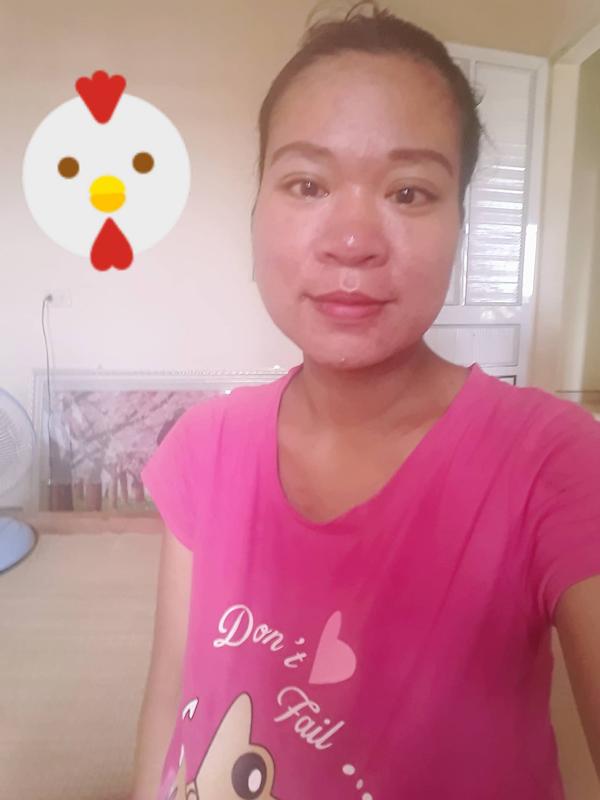 ca sinh doi "nho doi" cua me nghe an, thuoc te chua kip ngam bac si da "ha dao" mo - 2