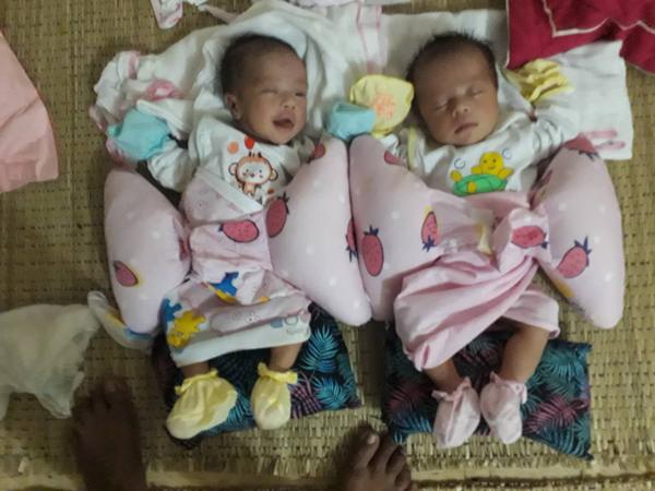 ca sinh doi "nho doi" cua me nghe an, thuoc te chua kip ngam bac si da "ha dao" mo - 5