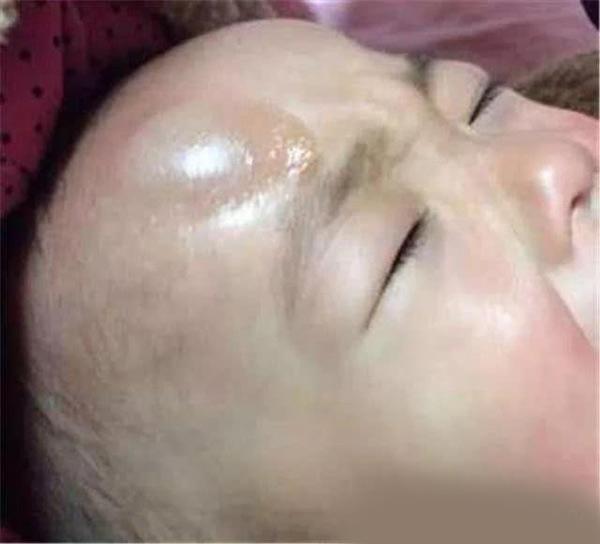 con dot nhien nga khoi giuong, phan ung cua bo me khien bac si bao “thoi xong roi!” - 3