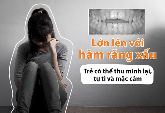 minh tung bi “am anh” tuoi tho chi vi “ham rang xau” - 1