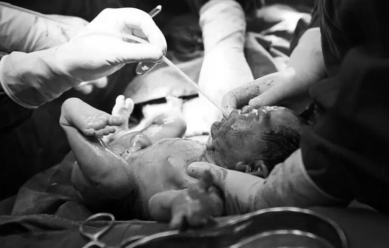 Vừa ra khỏi người mẹ, các cô y tá sẽ giúp bé làm sạch nước ối trong miệng. Trong lúc đó, bác sĩ sẽ cắt phần dây rốn nối với nhau thai.

