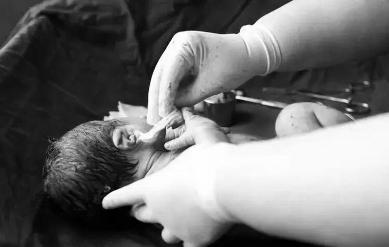 Cô y tá sẽ dùng bông y tế lau sạch những dịch nhầy trên người em bé, đặc biệt là ở mũi và hai tai. 
