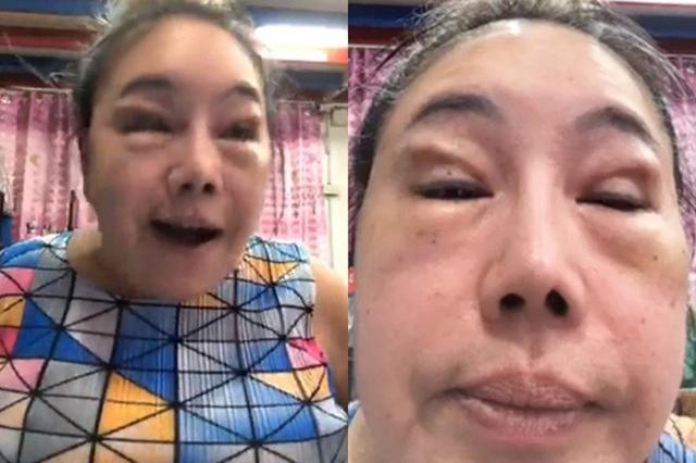 su that nhan sac nhu gai 20 cua nu dai gia tuyen chong "yeu" 28 lan/ngay sau tham my - 3